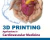 3d printing applications in cardiovascular medicin