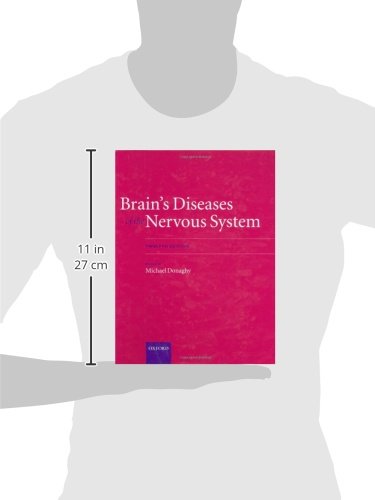 Brains Diseases of the Nervous System Online
