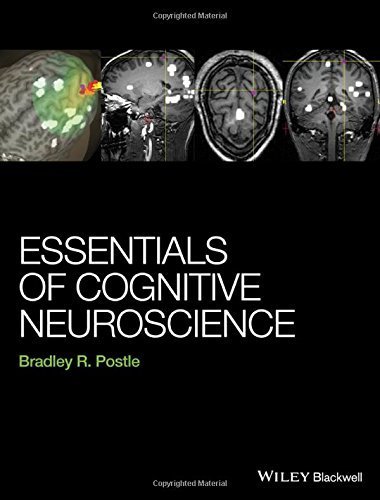 Essentials of Cognitive Neuroscience 1st edition by Postle, Bradley R. (2015) Hardcover