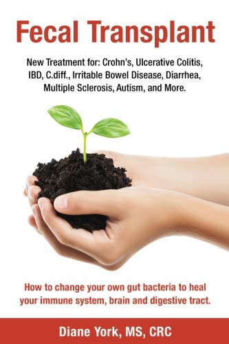 Fecal Transplant: New Treatment for Ulcerative Colitis, Crohn’s, Irritable Bowel Disease, Diarrhea, C.diff., Multiple Sclerosis, Autism, and More: How ... immune system, brain and digestive tract.